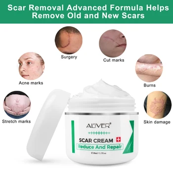 50ML Effectivel Cicatriz Eliminación Crema de Tratamiento Avanzado de la Cara y el Cuerpo las Cicatrices de los Cortes de las Marcas de Estiramiento C-Secciones Cirugías de Cuidado de la Piel