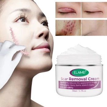 50ML Effectivel Cicatriz Eliminación Crema de Tratamiento Avanzado de la Cara y el Cuerpo las Cicatrices de los Cortes de las Marcas de Estiramiento C-Secciones Cirugías de Cuidado de la Piel