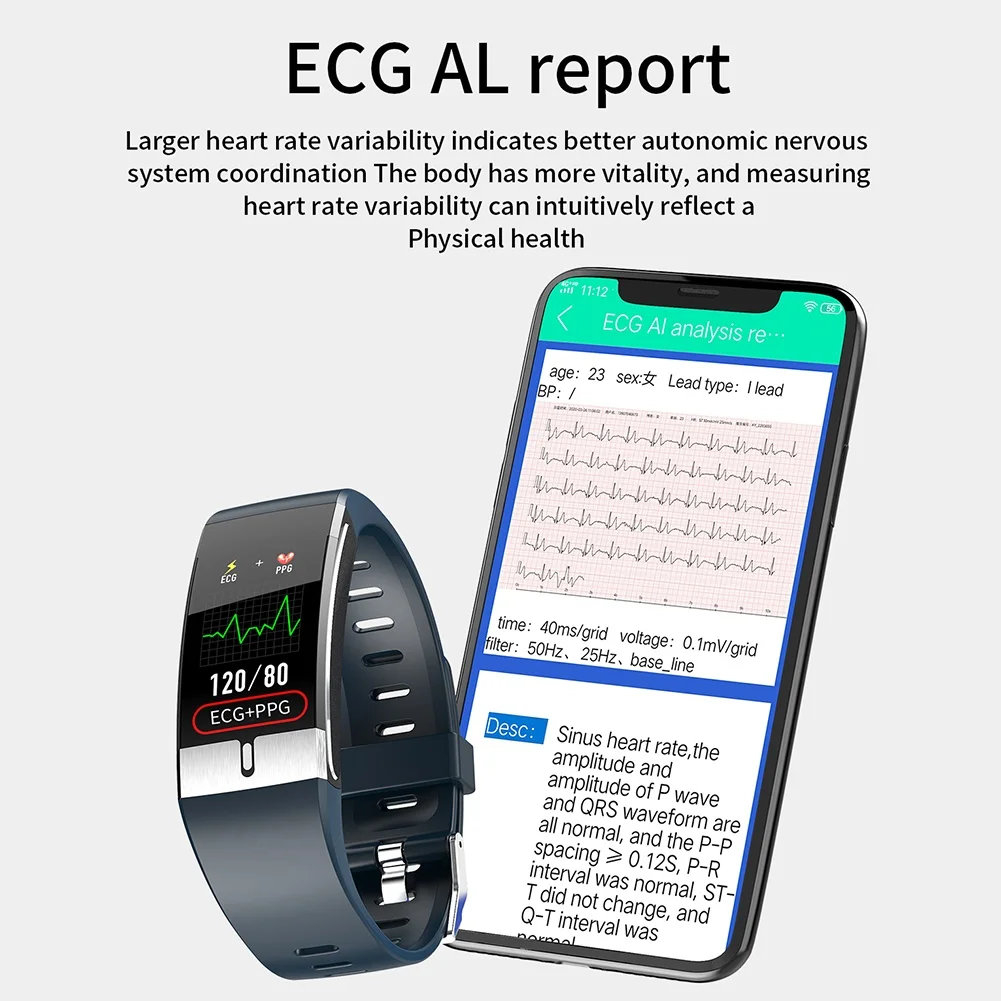 Fitness Tracker Pulsera E66 la Temperatura del Cuerpo ECG Inteligente de Pulsera con Monitor de Ritmo Cardíaco Reloj Inteligente de Control de Música del Deporte de la Banda 0