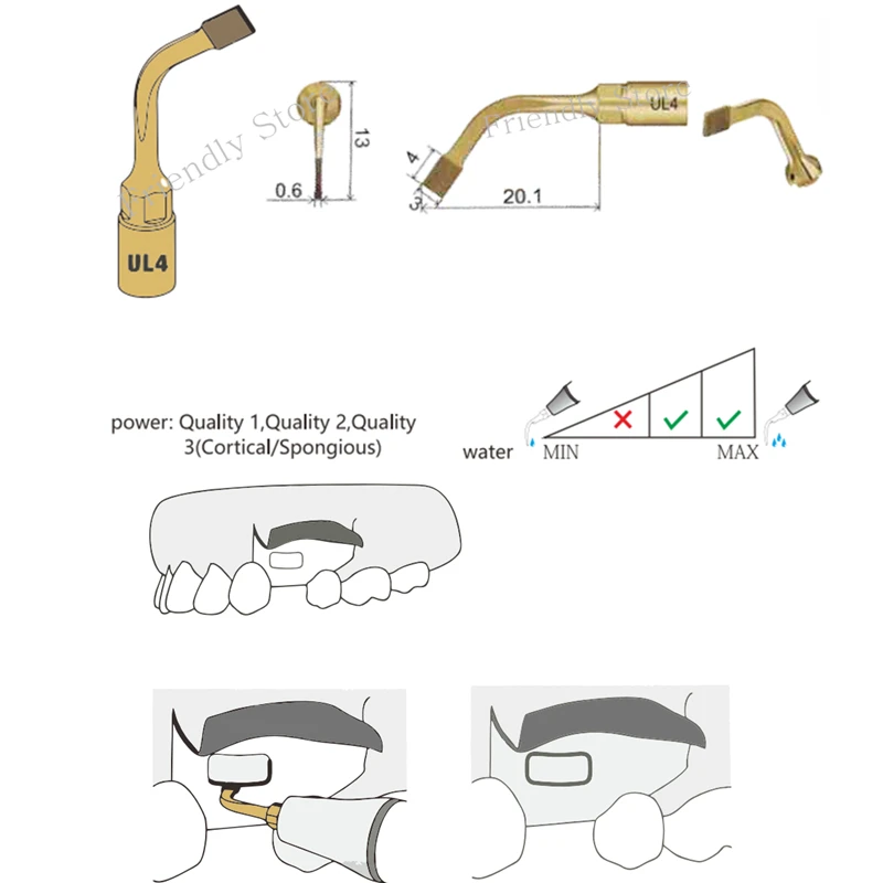 Material Dental Dentes Consejos Con recubrimiento de Diamante de Elevación de Seno Punta 1PCS UL4 Por MECTRON Y CARPINTERO Piezosurgery Equipo 0