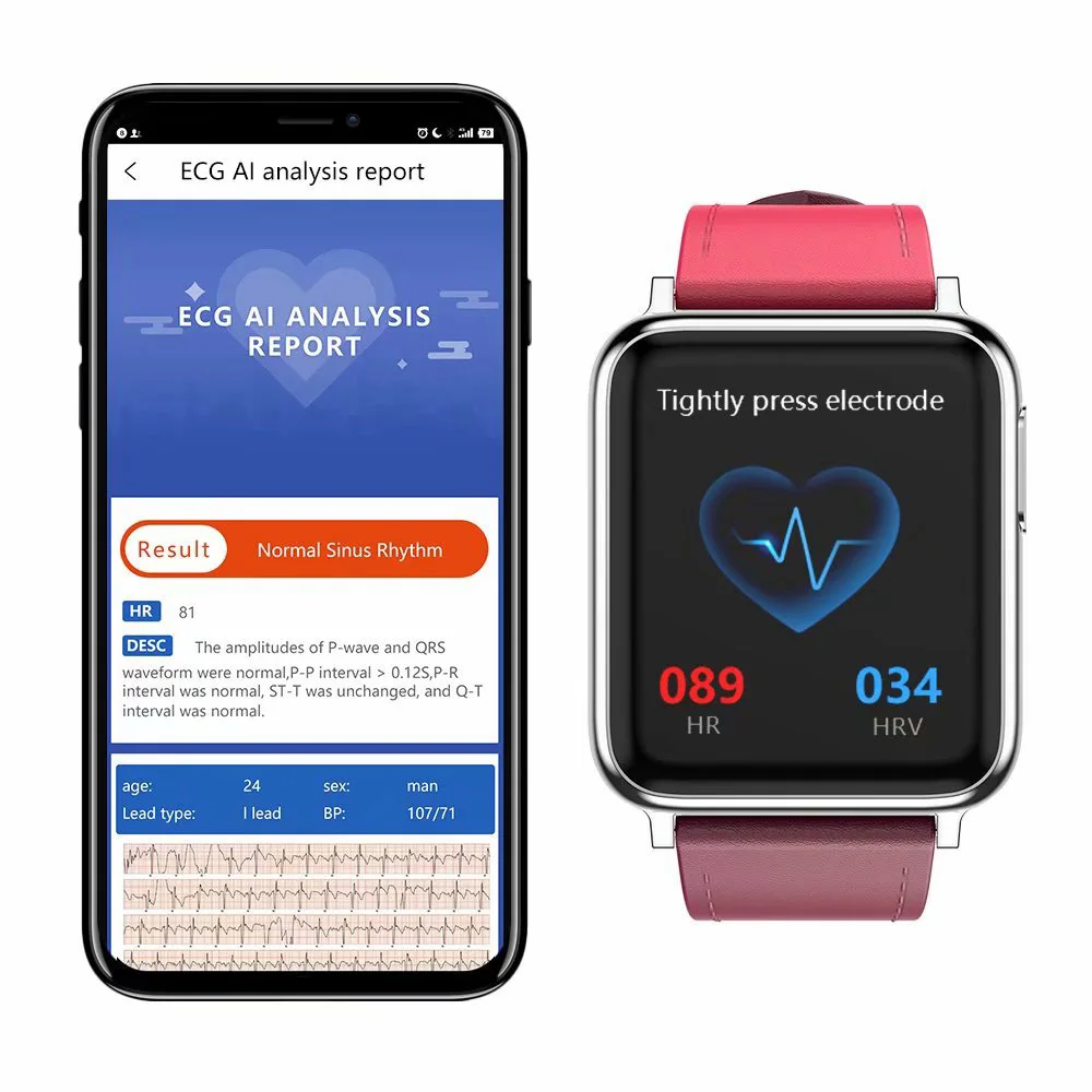 ECG PPG Inteligente de la Banda de Reloj de los Hombres de la Presión Arterial de Oxígeno Monitor de Ritmo Cardíaco Smartwatch de las Mujeres Impermeables para Android IOS Xiaomi 3